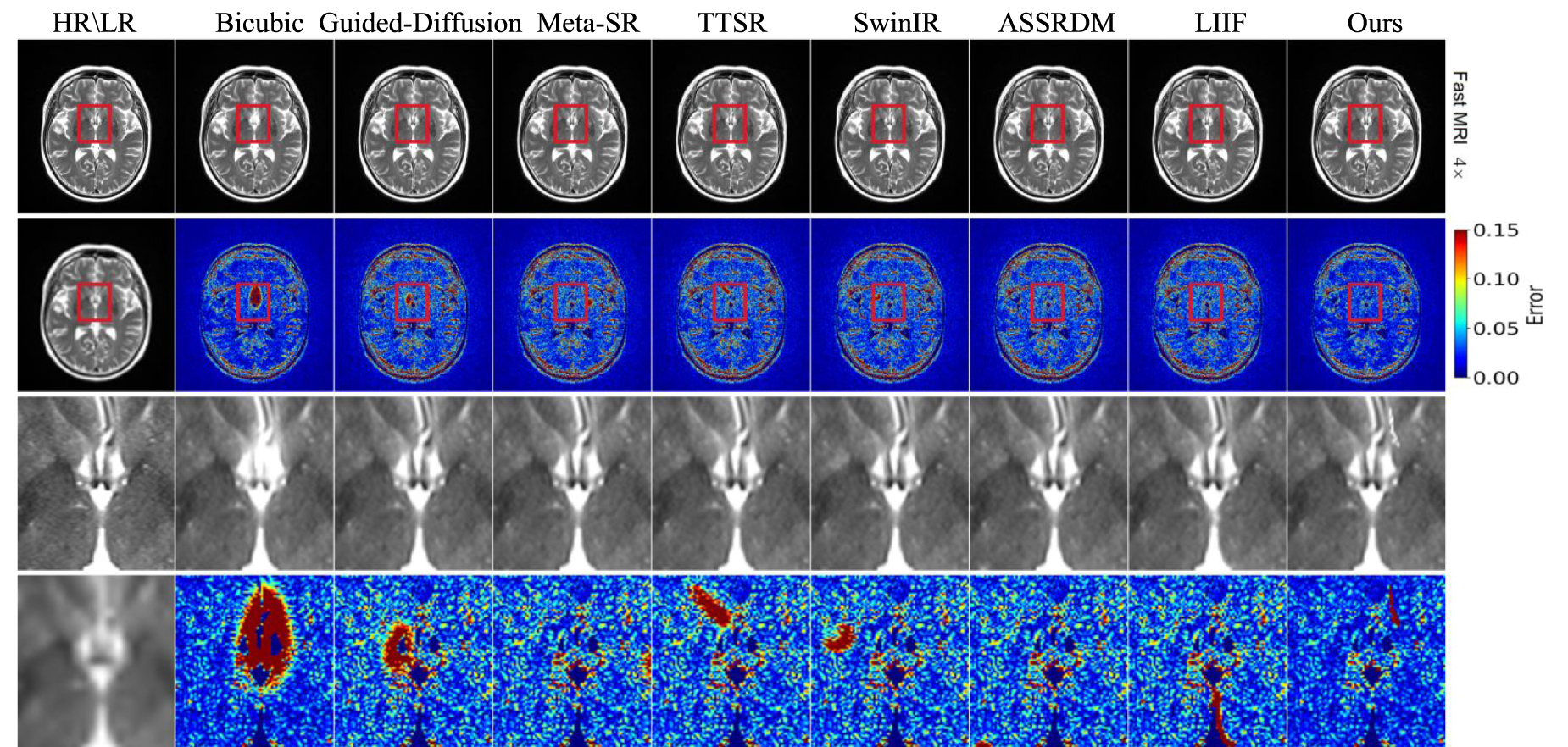 Kernel-aware network with dual diffusion model for MRI blind super  resolution - IOPscience