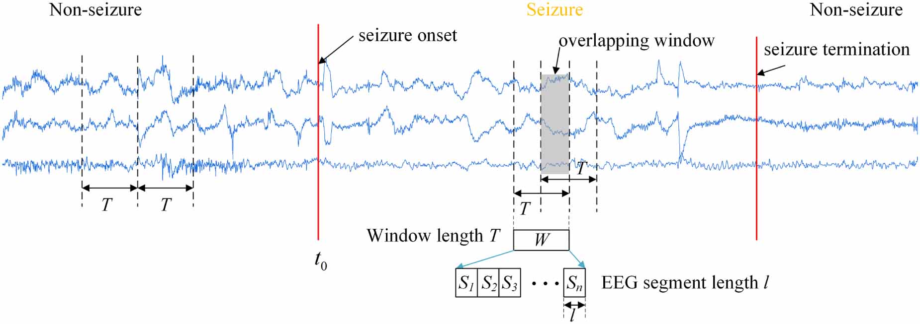 Dynamic spatiotemporal graph neural network for patient-independent ...