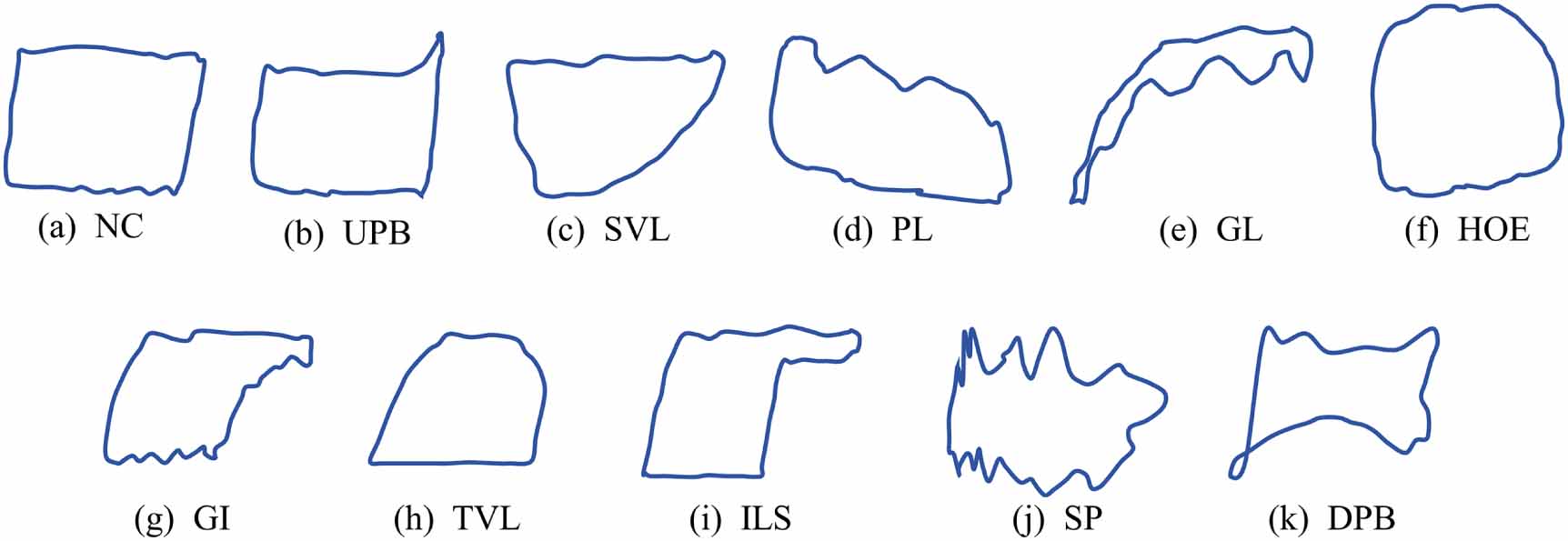 Subsurface Dynamometer Card Research on few-shot working condition recognition method for pumping ...