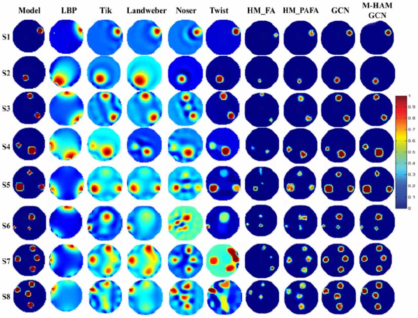 Edge-prioritization based multi-head attention in graph convolutional ...