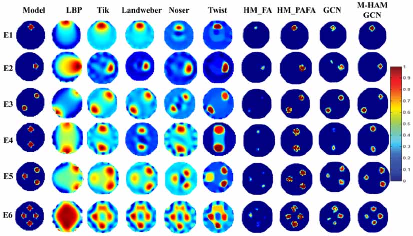 Edge-prioritization based multi-head attention in graph convolutional ...