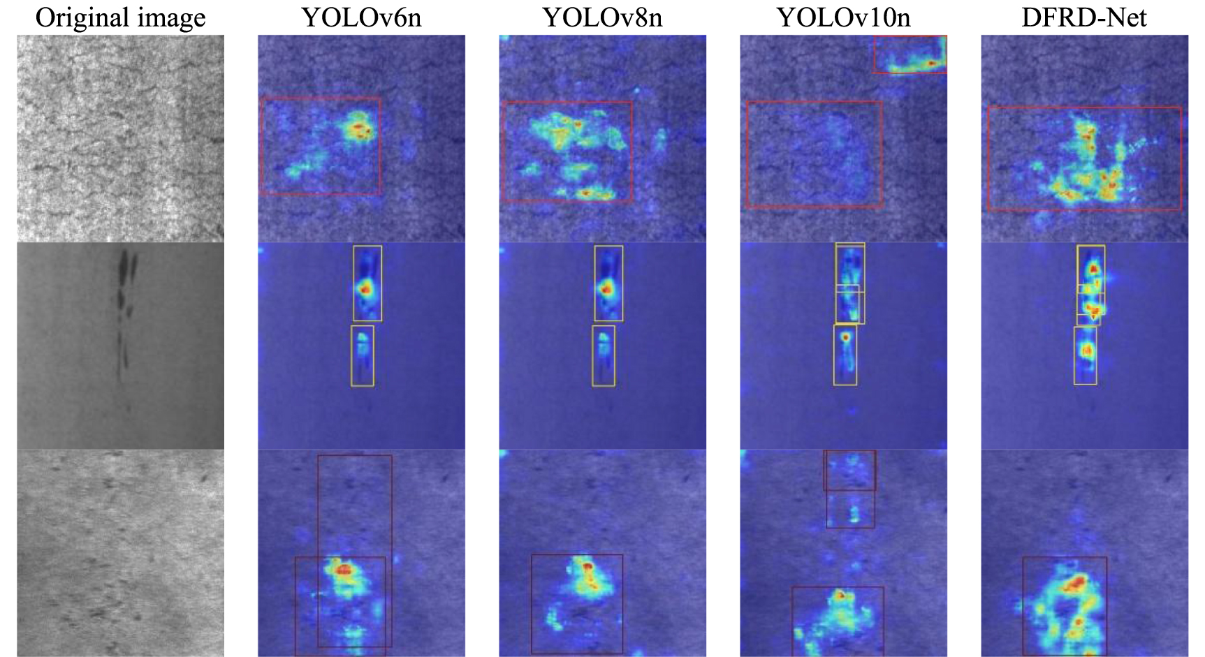 DFRD-Net: dual-domain feature representation dynamic network for steel ...