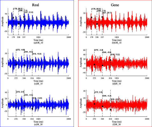 An intelligent fault diagnosis method based on data enhancement by ...