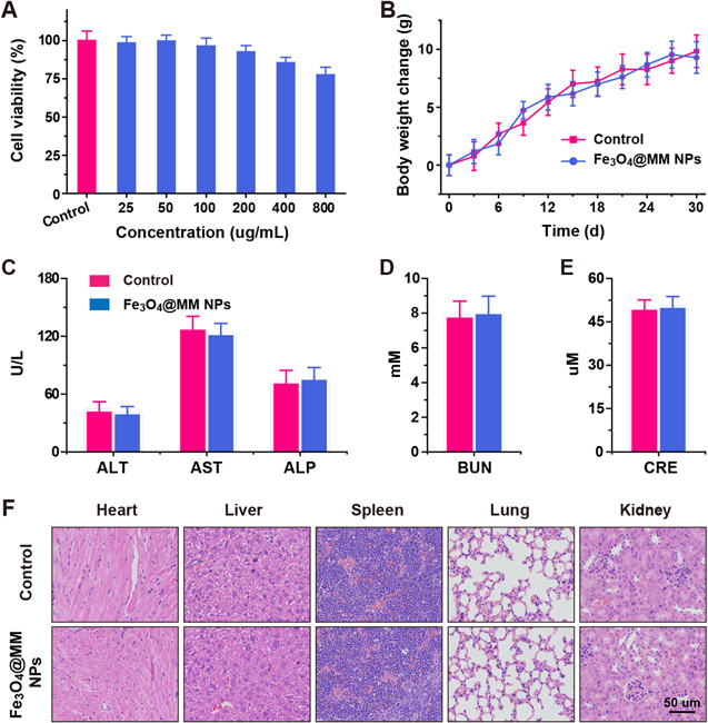 Macrophage membrane-coated iron oxide nanoparticles for enhanced ...