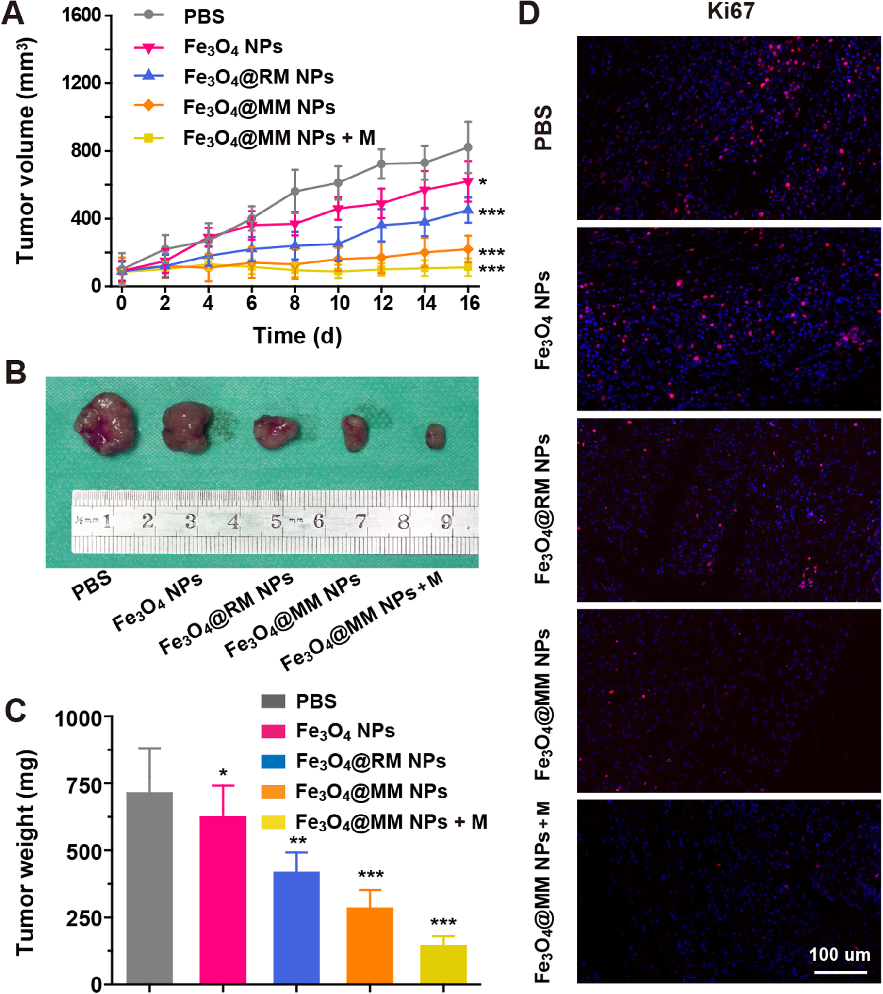 Macrophage membrane-coated iron oxide nanoparticles for enhanced ...