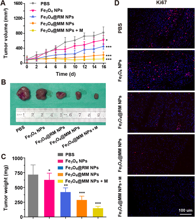 Macrophage membrane-coated iron oxide nanoparticles for enhanced ...