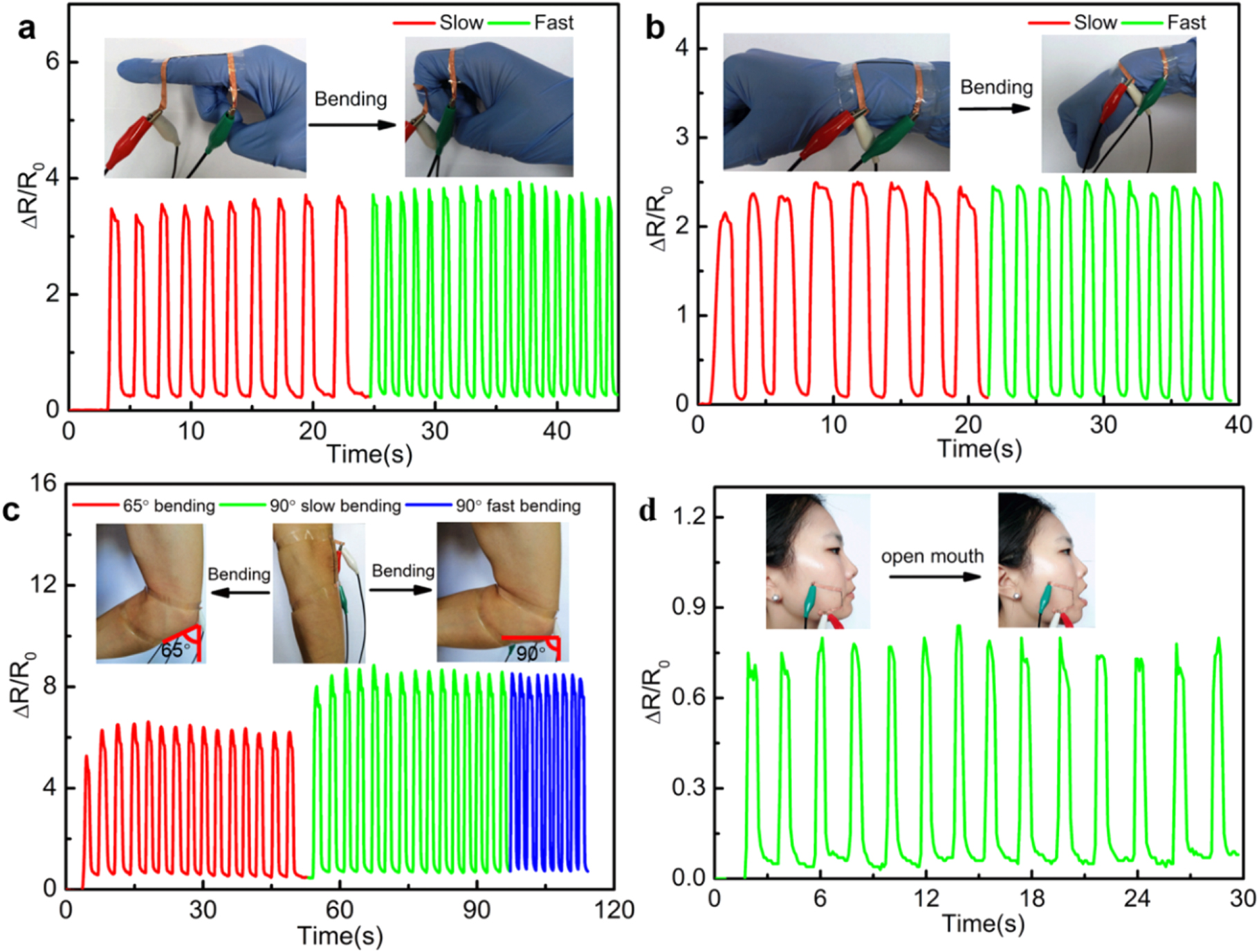 Wearable strain sensor based on highly conductive carbon nanotube ...