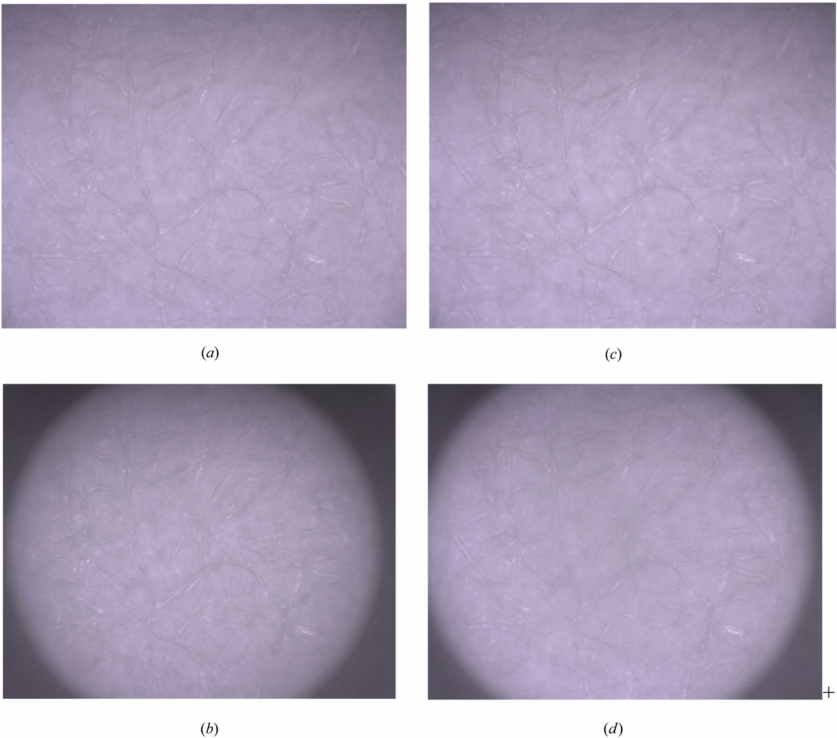Deep wet etching of borosilicate glass and fused silica with dehydrated ...