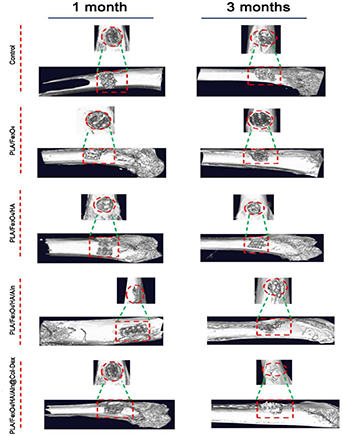 In-vitro and in-vivo studies of 4D printed shape memory scaffolds with ...