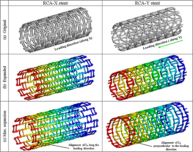 3D printed auxetic stents with re-entrant and chiral topologies ...