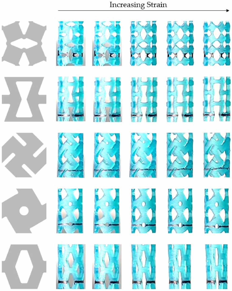 Auxetic fixation devices can achieve superior pullout performances ...