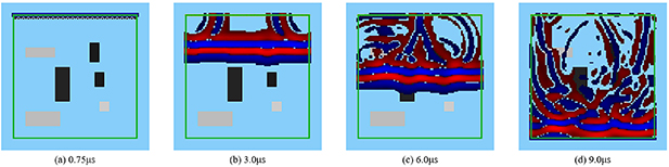 A deep learning-based approach to improve reconstruction of ultrasound ...