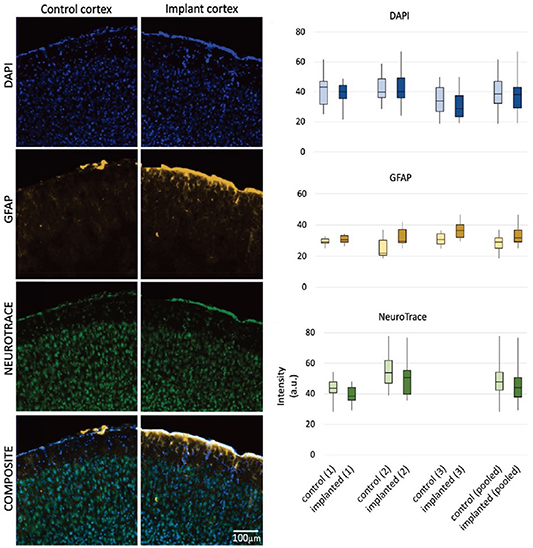 Shape memory polymers for neural interfaces: a mini-review - IOPscience