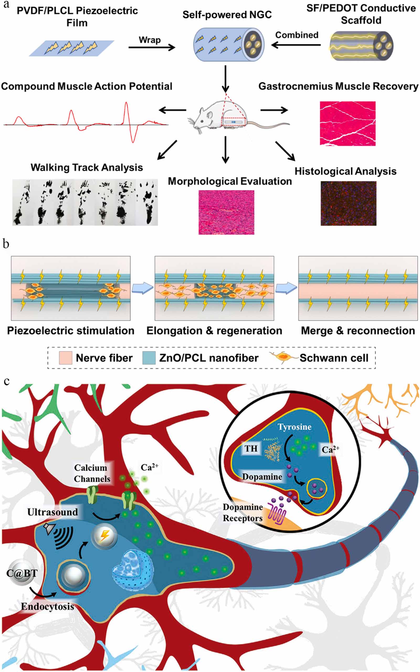 Research progress of piezoelectric materials in biomedicine - IOPscience