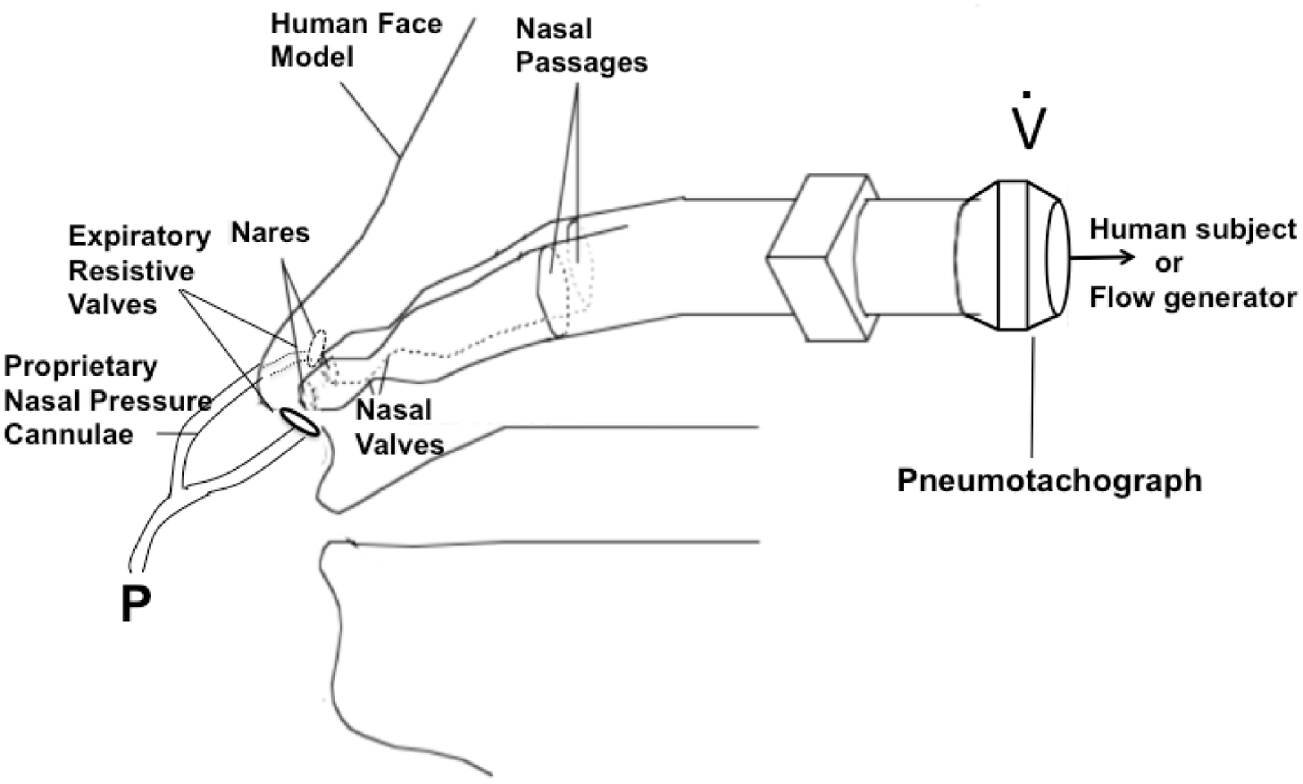 Provent Device Sensitivity and specificity of hypopnoea detection using nasal pressure ...