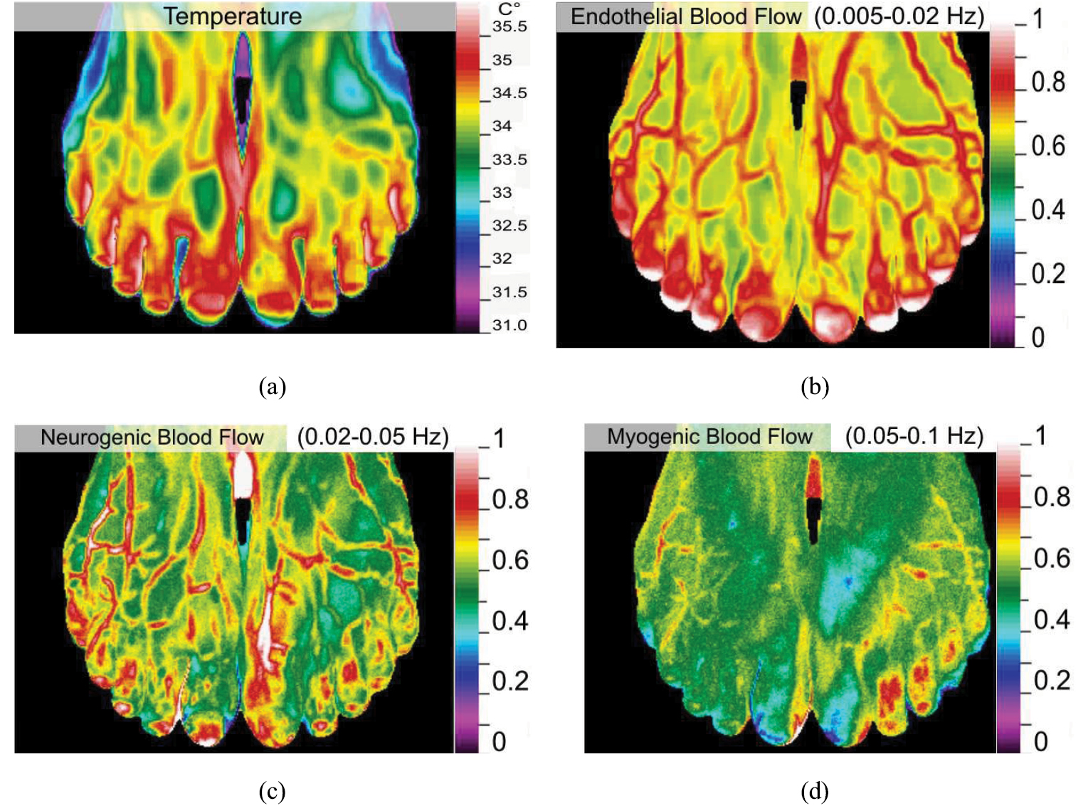 Thermography-based blood flow imaging in human skin of the hands and ...
