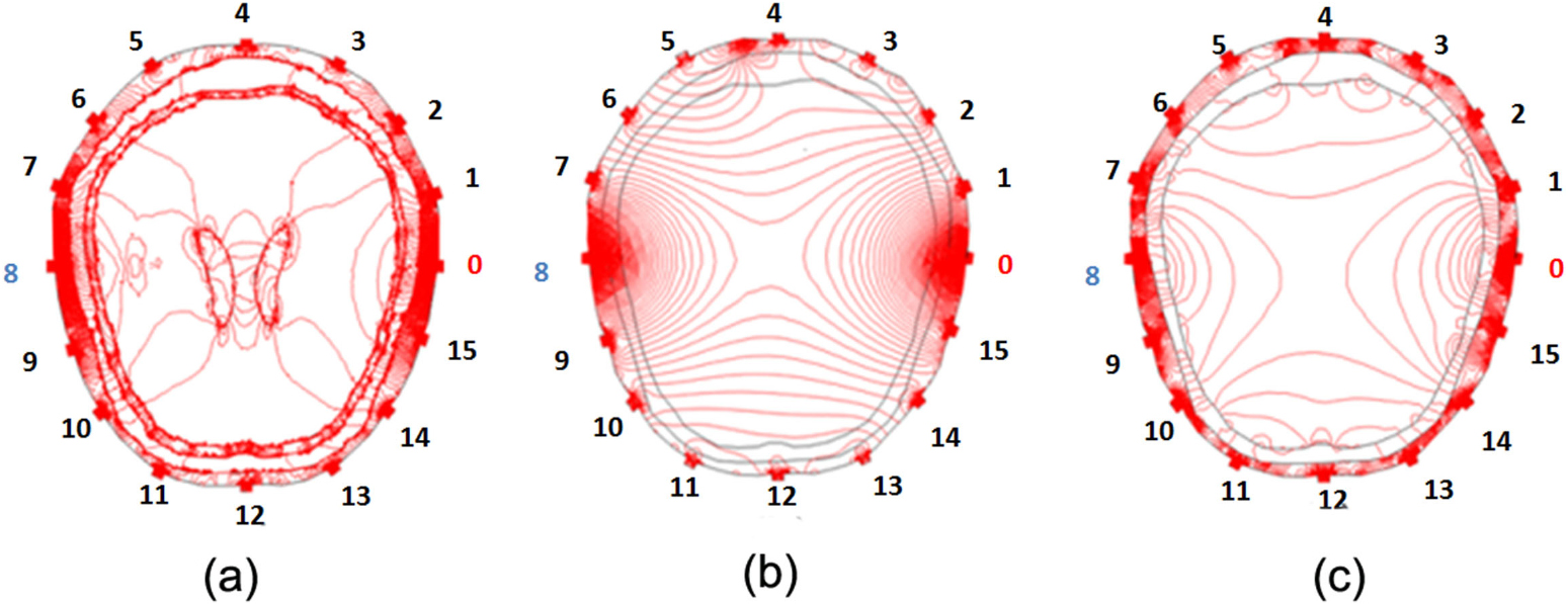 Unveiling the development of intracranial injury using dynamic brain ...