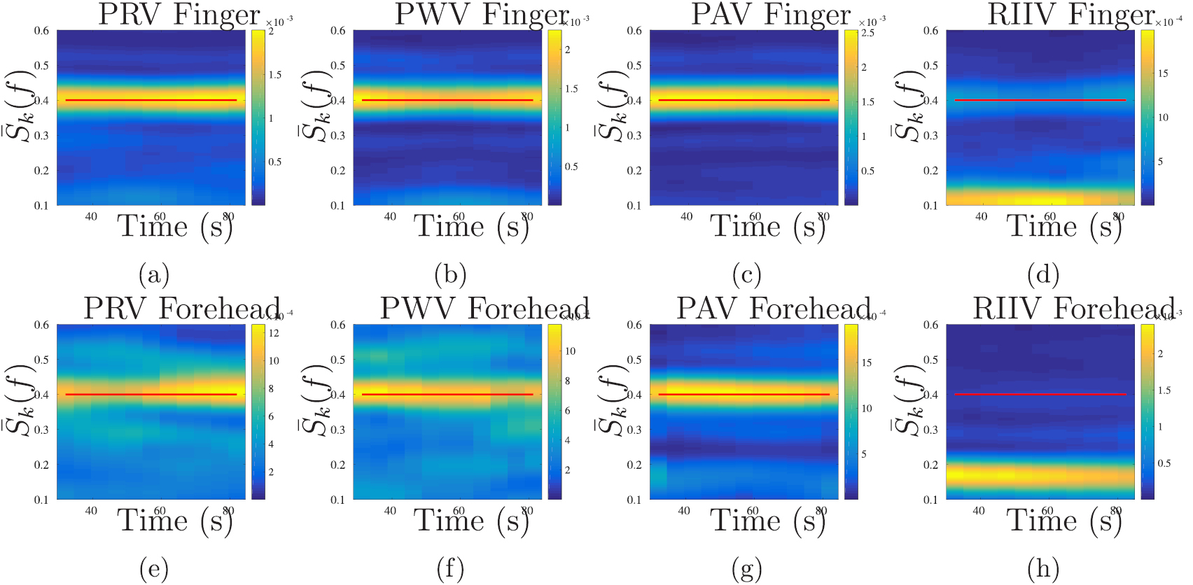 Finger and forehead PPG signal comparison for respiratory rate ...