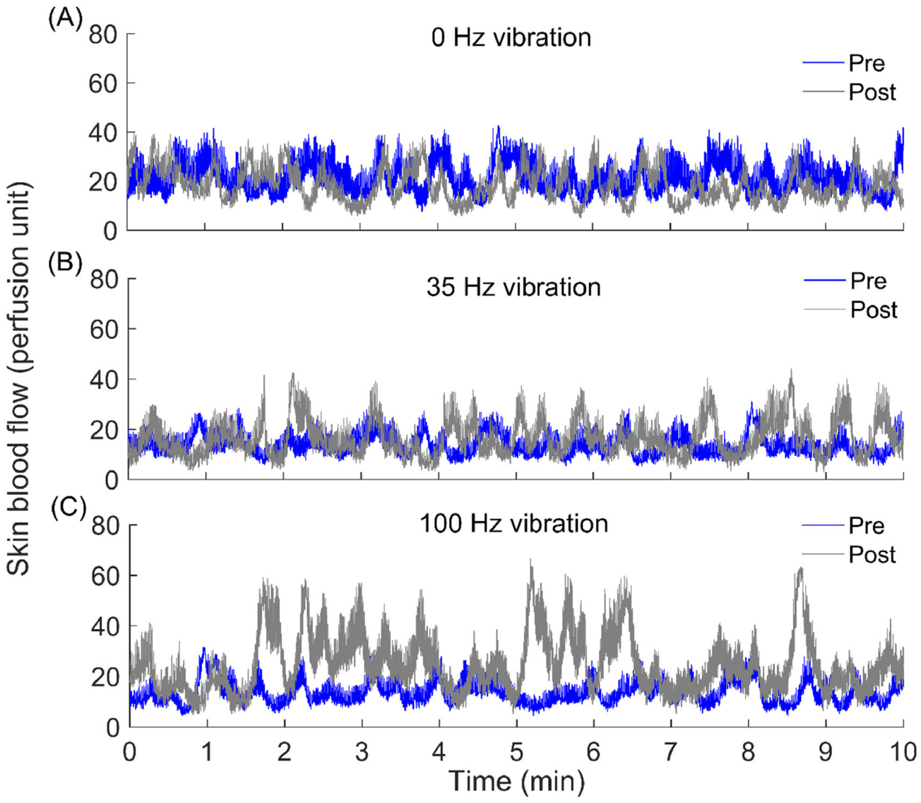 Wavelet-based analysis of plantar skin blood flow response to different ...