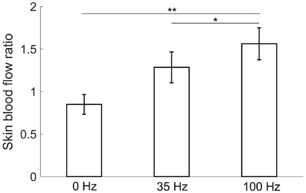 Wavelet-based analysis of plantar skin blood flow response to different ...