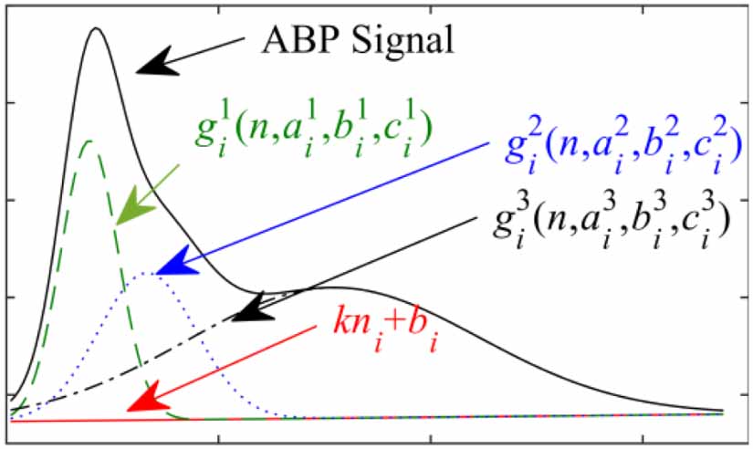 A recognition method for extreme bradycardia by arterial blood pressure ...