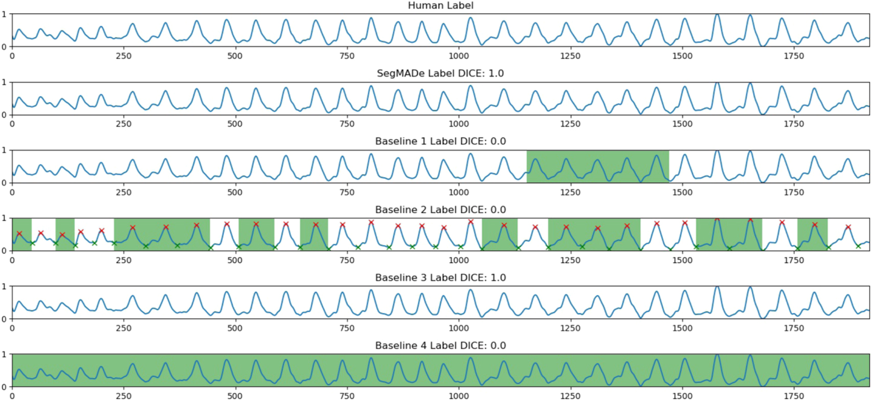A supervised machine learning semantic segmentation approach for ...