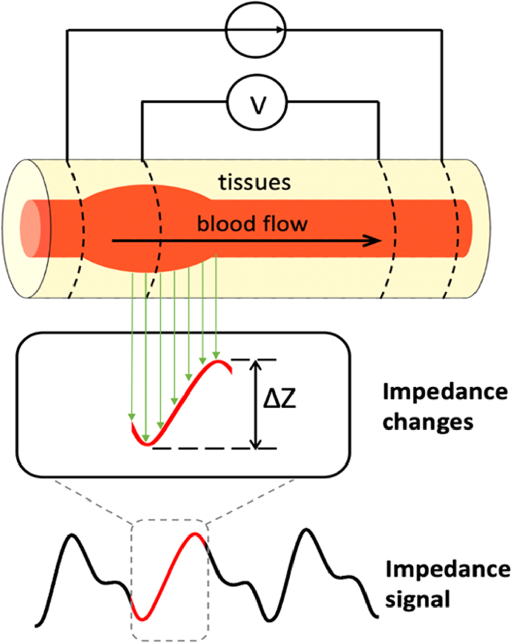 Bioimpedance Formulas Bioimpedance analysis as a tool for hemodynamic monitoring: overview ...