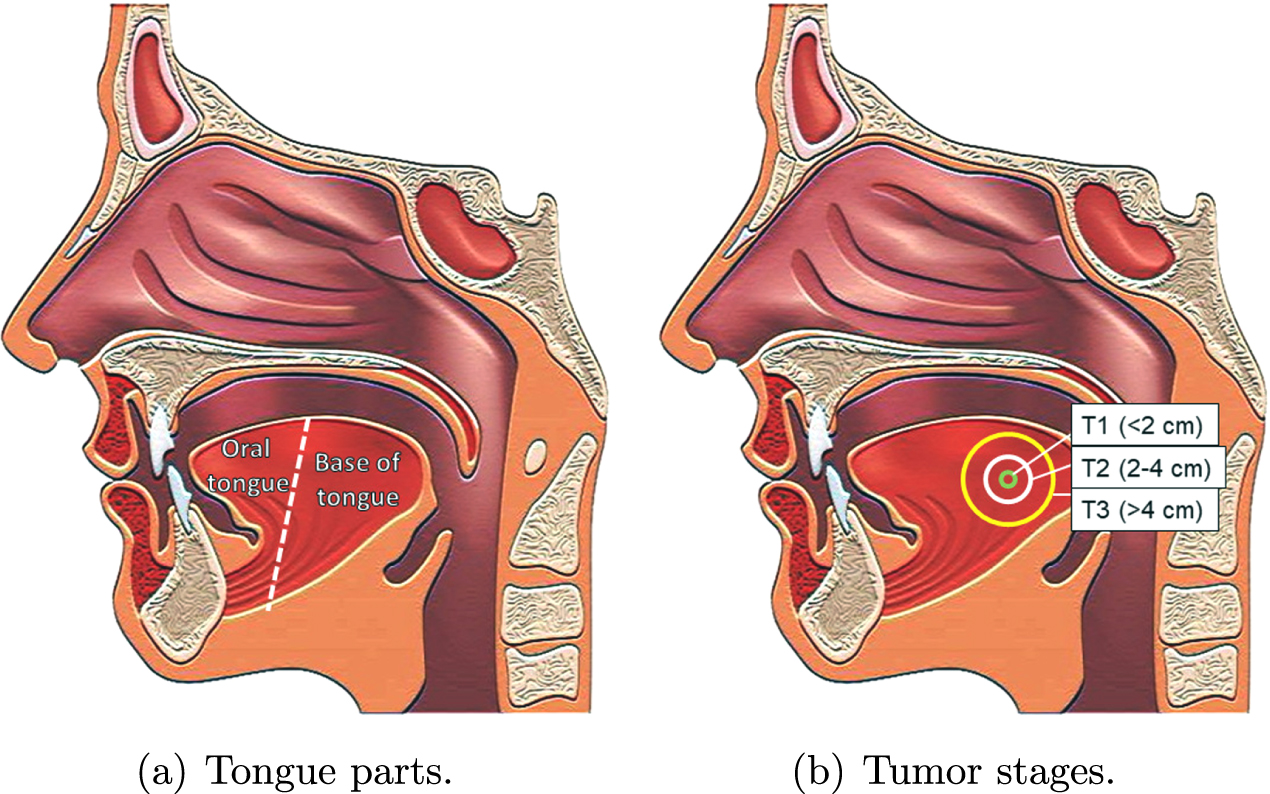 Electrical impedance tomography: a potential tool for intraoperative ...