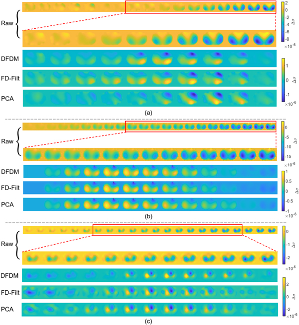 Domain Separation Networks Deep feature-domain matching for cardiac-related component separation ...