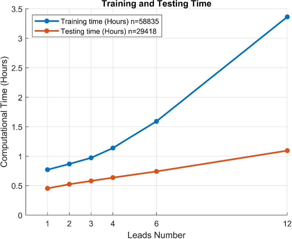 From 12 to 1 ECG lead: multiple cardiac condition detection mixing a ...