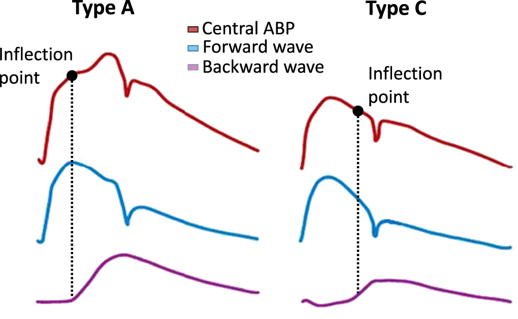 Pulse wave analysis as a tool for the evaluation of resuscitation ...