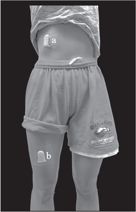 Validity of ActivPAL CREA software detection of sitting and lying ...