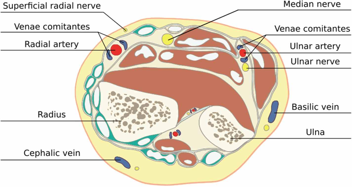 Survey on portable sensing technologies for the radial artery ...