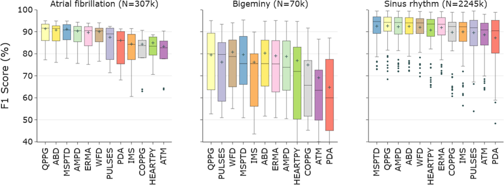 The influence of cardiac arrhythmias on the detection of heartbeats in ...