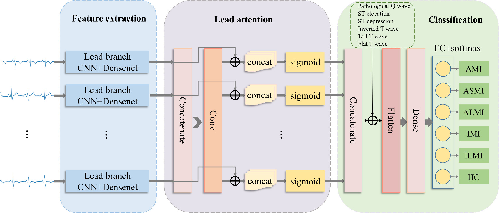 Multi-branch myocardial infarction detection and localization framework ...