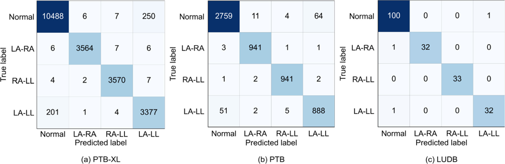 A lightweight deep learning approach for detecting electrocardiographic ...