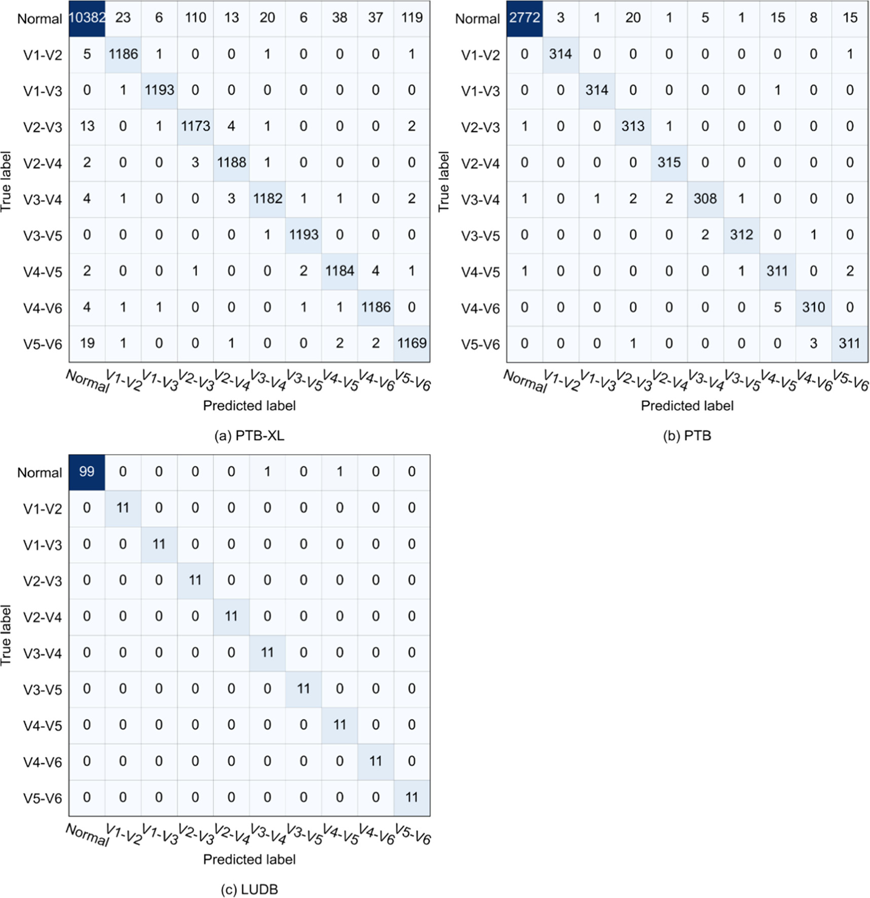 A lightweight deep learning approach for detecting electrocardiographic ...
