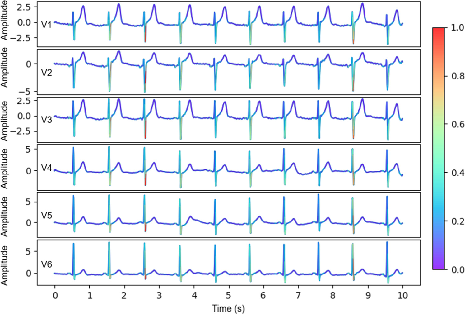 A lightweight deep learning approach for detecting electrocardiographic ...