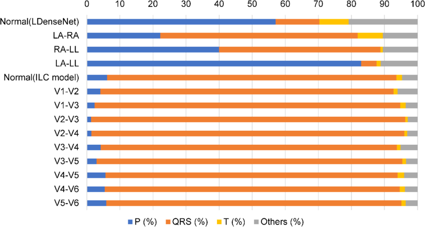 A lightweight deep learning approach for detecting electrocardiographic ...