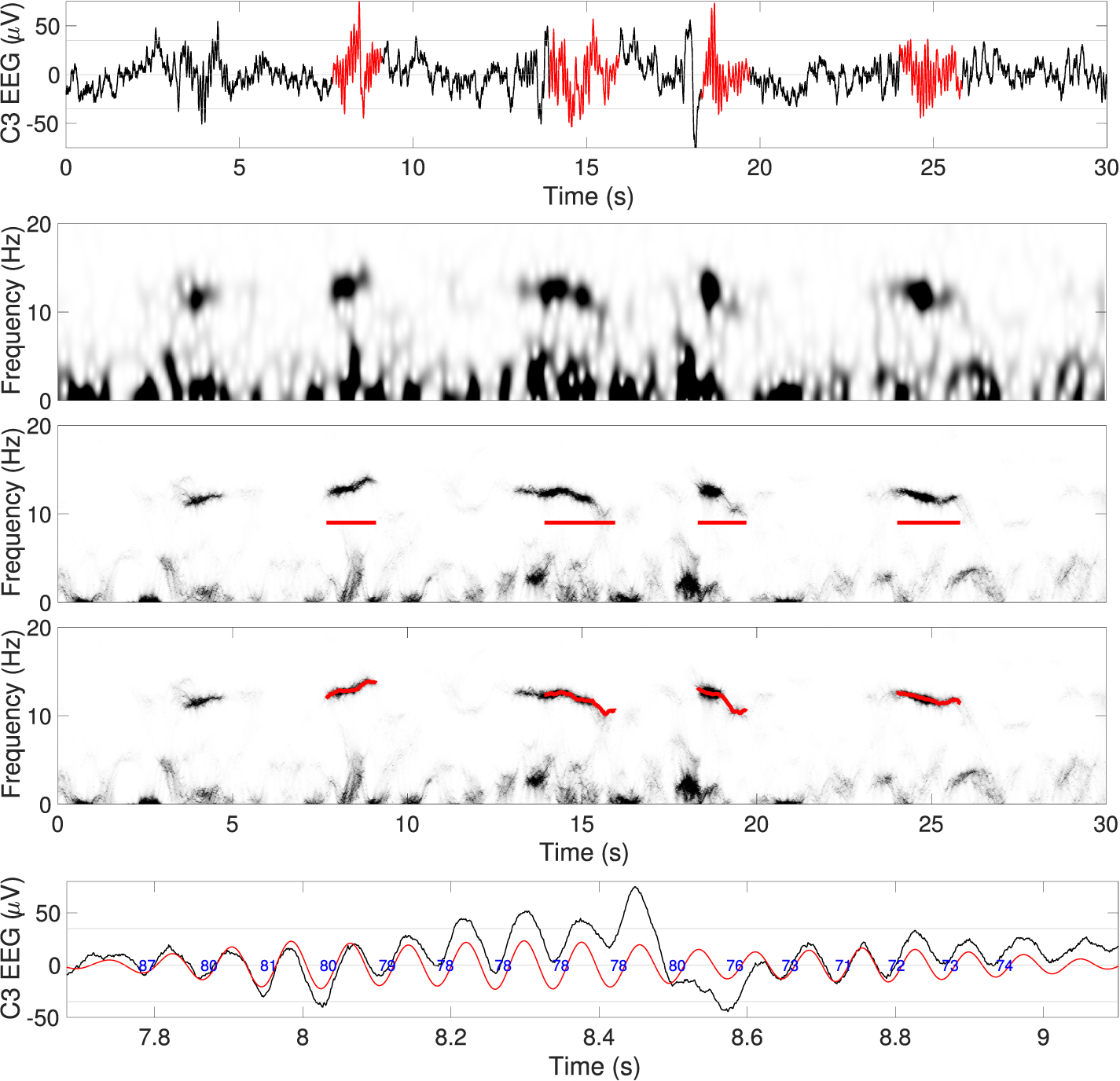 Unveil sleep spindles with concentration of frequency and time (ConceFT ...