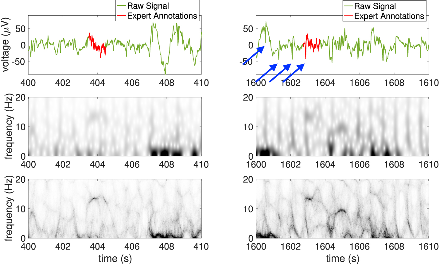 Unveil sleep spindles with concentration of frequency and time (ConceFT ...