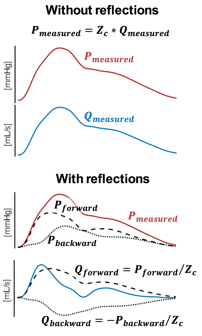 The role of pulse wave analysis indexes for critically ill patients: a ...