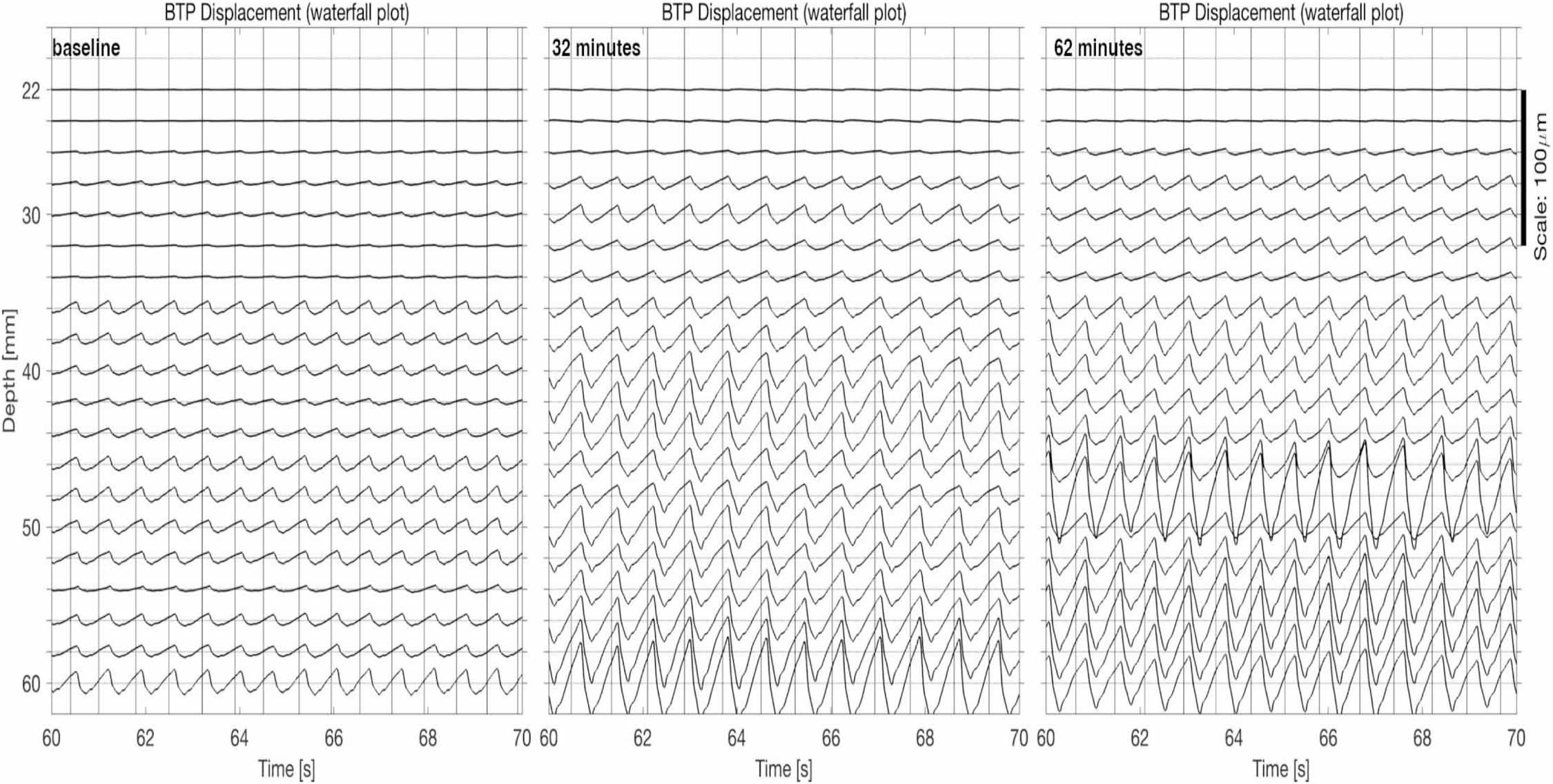 Pulsation of brain tissue increases in response to caffeine: a pilot ...