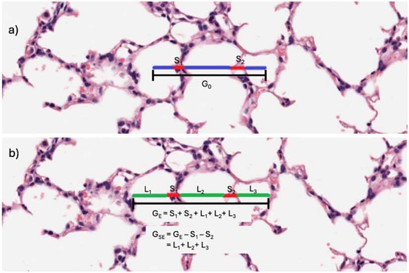 Automated mean linear intercept measurement: quantifying bias and ...