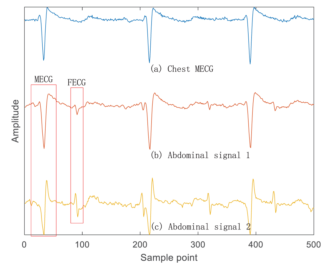 Deep source separation for single-channel fetal ECG extraction - IOPscience