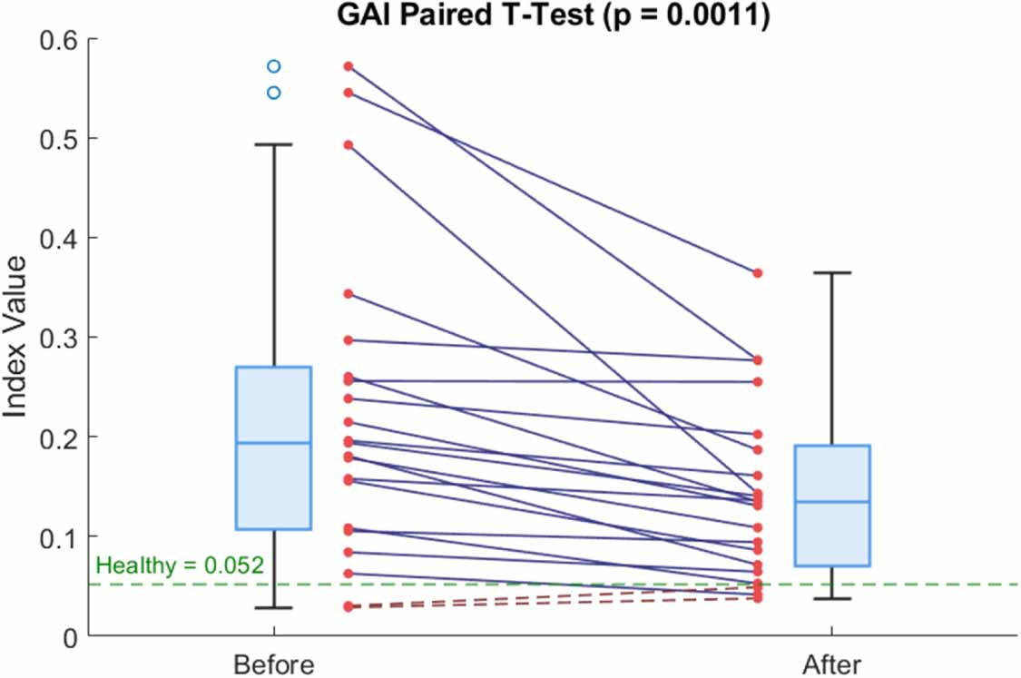 Gai Calculation A robust temporal metric of ventilation inhomogeneity in electrical ...