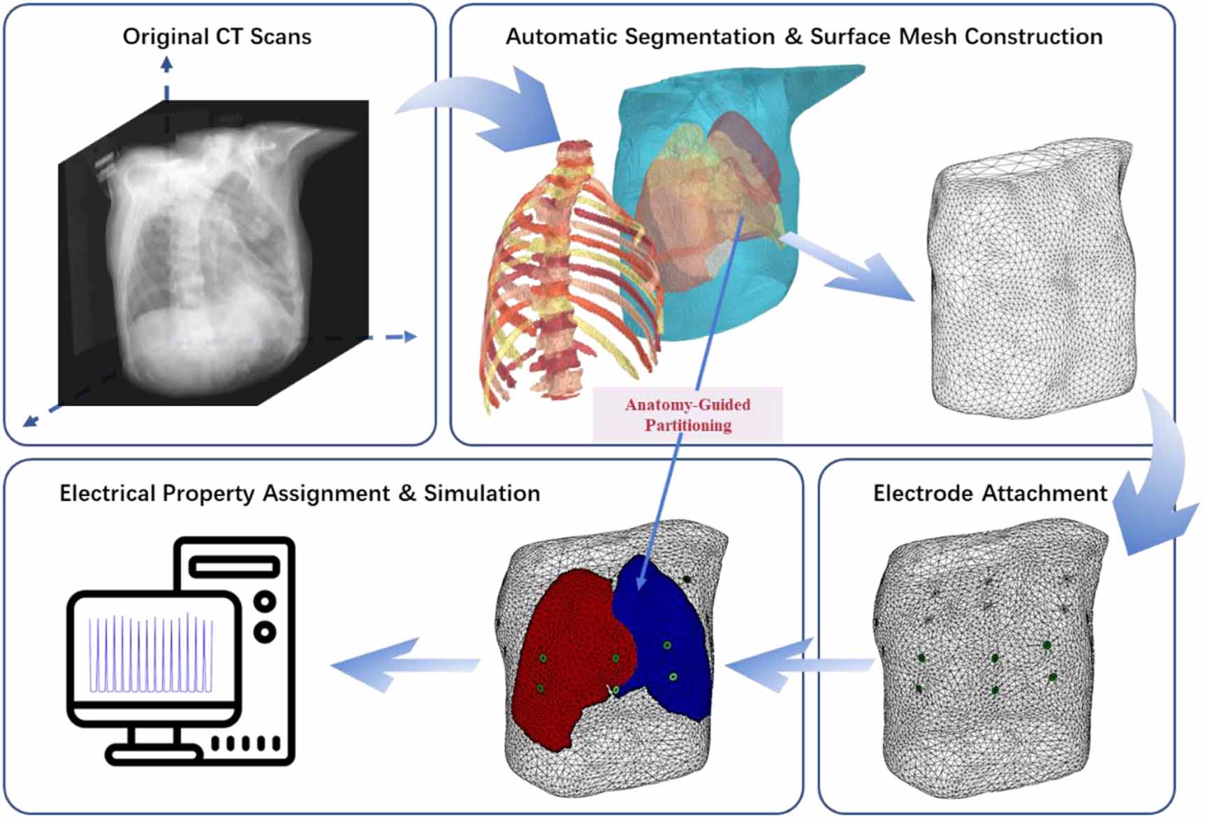 StructEIT: realistic 3D EIT model generation from CT scans for deep ...