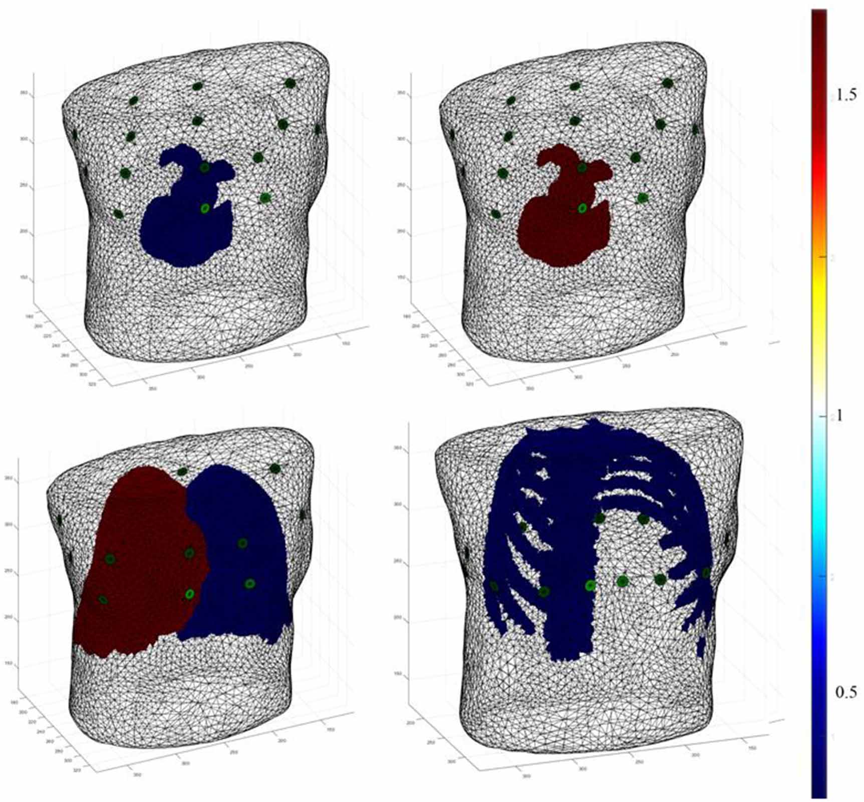 StructEIT: realistic 3D EIT model generation from CT scans for deep ...