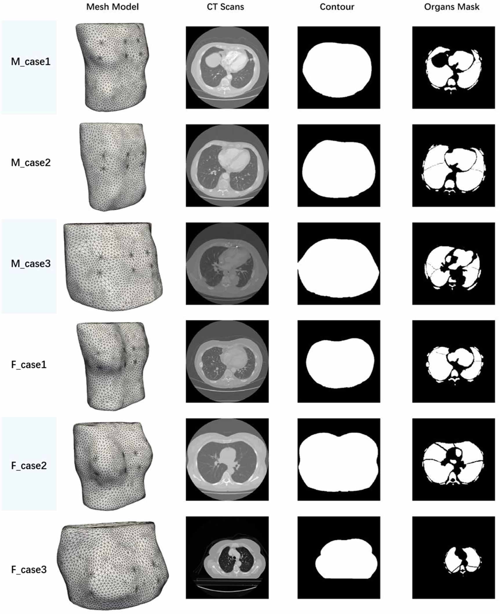 StructEIT: realistic 3D EIT model generation from CT scans for deep ...
