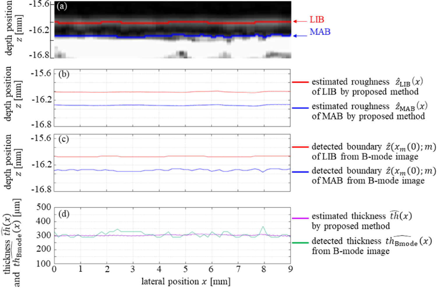 Ultrasonic measurement of thickness of carotid arterial wall using its ...